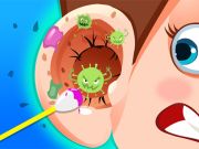 שפּיל Earwax קינילק אָנליין