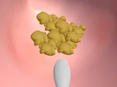 שפּיל Earwax Clinic אָנליין