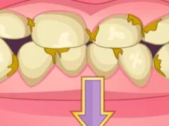 שפּיל Bad Teeth Makeover אָנליין
