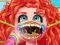 שפּיל Treating stuck fish bone אָנליין