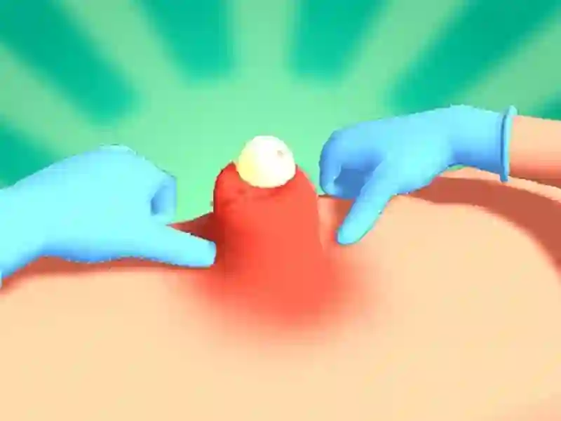 שפּיל Pimple Squeeze אָנליין