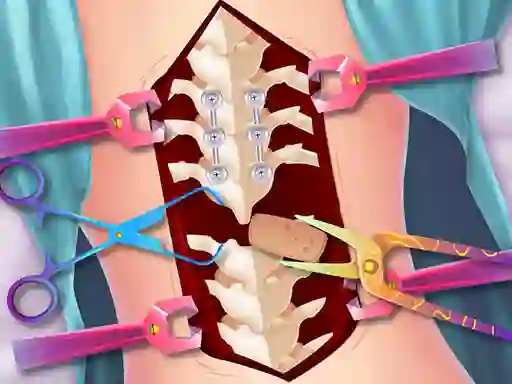 שפּיל Anna Scoliosis Surgery אָנליין